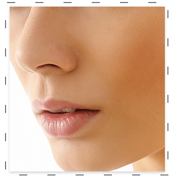 foto-rinoplastia foto-rinoplastia