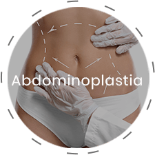 img-abdominoplastia
