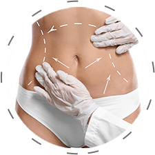 img-abdominoplastia-hover