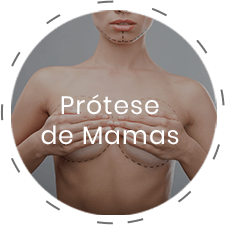 img-protese-de-mamas